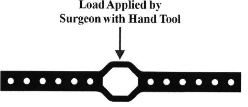 Figure  2-4:  Load  Applied  to  Bone  Plate  by  Surgeon  to Manipulate  Deformation