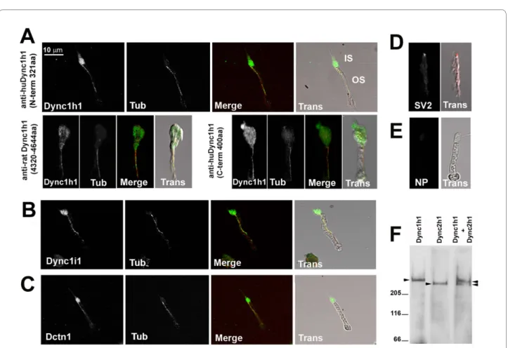 Figure 7 Dync1h1, Dync1i1, and Dnct1 immunoreactivity is associated with photoreceptor axonemes