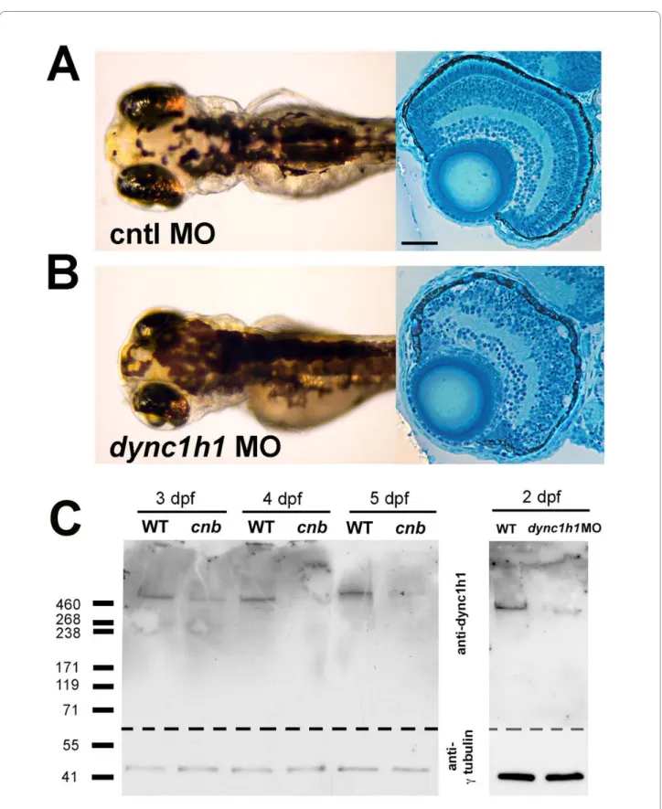 Figure 3 Morpholino knock-down of dync1h1 phenocopies cnb mutants. (A, B) Dorsal views and retinal histology of control (cntl) morpholino  (MO) injected (A) and dync1h1 ATG MO injected (B) embryos shown at 3.5 dpf
