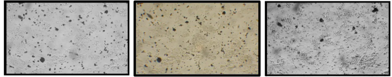 Figure S2. Brightfield images of A549 (left), HepG2 (middle) and SH-SY5Y (right) cells  exposed to 200 μg/mL of 25 nm CuNPs immediately after exposure