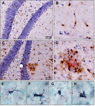 Figure 2. Microglia in a triple transgenic mouse model of Alzheimer’s disease (3xTg-AD)