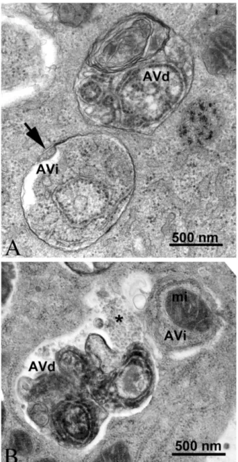 Figure 3. TEM images of autophagic vacuoles in isolated mouse hepatocytes. (A)  One  autophagosome  or  early  autophagic  vacuole  (AVi)  and  one  degradative  autophagic  vacuole  (AVd)  are  shown