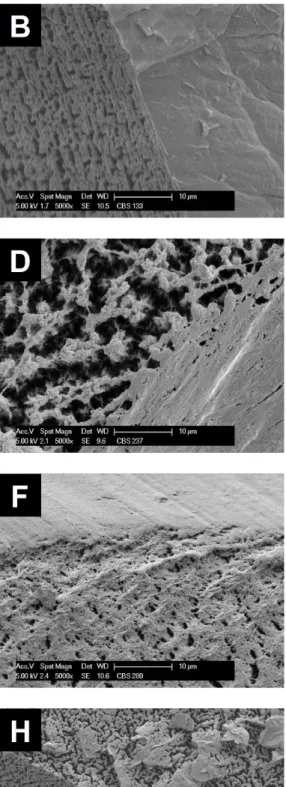 Figure 3. SEM micrographs of the interior (A, C, E, G) and near-surface breaking edge (B, D, F, H) of aerogels from non-derivatized cellulose (CL: A, B; hwPHK: E, F) and their phosphorylated counterparts (CL-P: C, D; hwPHK-P: G, H) at different magnificati
