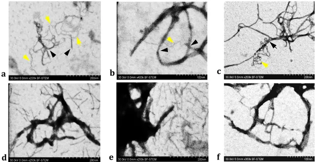 Figure  S4:  High  resolution  bright  field  STEM  images  by  Hitachi  S-5500  cold  field  emission SEM: complexation by TBL/TB-FITC with (a) Extra-washed circular mCherry  plasmid  DNA,  (b)  mCherry  DNA  cassette  and  (c)  Linear  mCherry  plasmid  