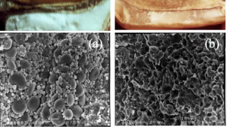Figure 2 : Photos de coupes de grain et  images de microscopie électronique à  balayage correspondant respectivement à un  albumen de blé de type farineux (a) ou vitreux  (b)