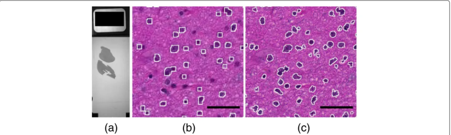 Figure 1 A sample slide. (a): macroscopic view of the whole slide (the black rectangle on the left is 1x2 cm)