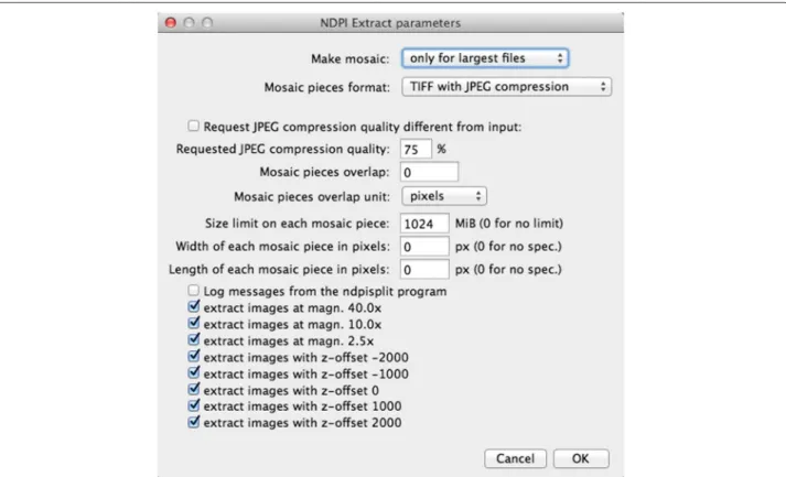 Figure 4 Dialog box for customized extraction in ImageJ from an NDPI file with production of a mosaic
