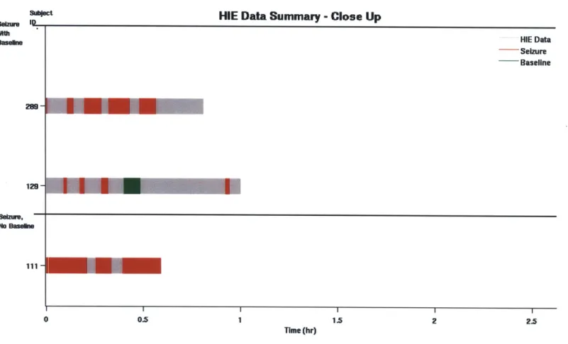 Figure  3-7:  Close  up  of  HIE  database  reveals  variability  in  seizure  duration