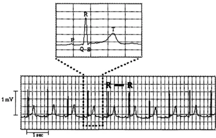 Figure  2-1:  Electrocardiogram  record  of  cardiac  electrical  activity.