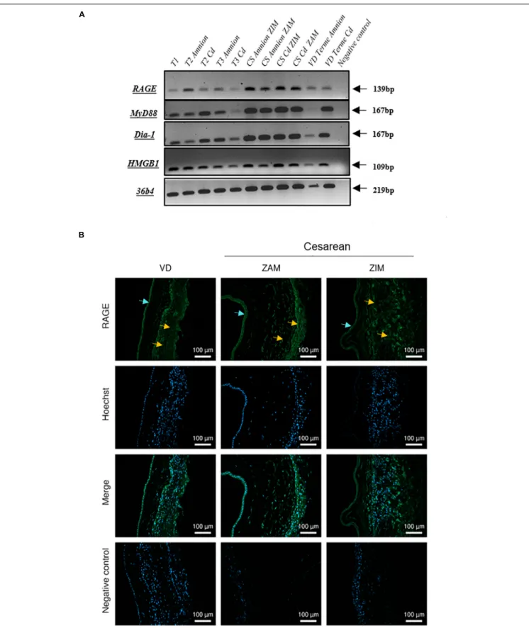 FIGURE 1 | Expression of RAGE-signaling actors in human fetal membranes. (A) RNA expression of the RAGE, Myd88, Diaphanous-1, and HMGB1 was detected by RT-PCR on the amnion and choriodecidua (Cd) samples from the different trimesters (T1, T2, and T3), caes