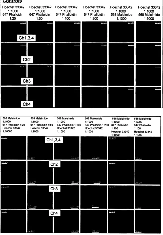 Figure  4  Representative  images  of channels  2,  3, and 4  during  four channel staining