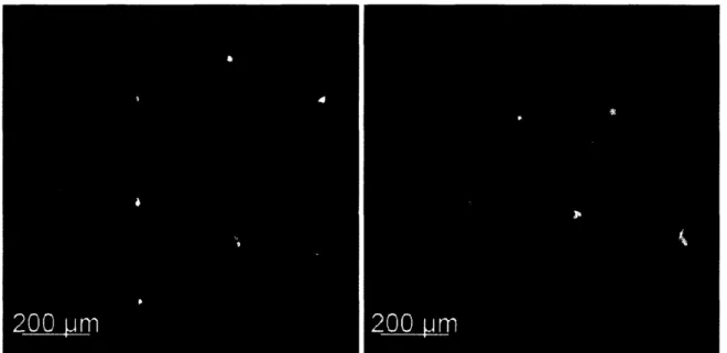 Figure 2  The image on the left shows  a field of sickly  or dead SR cells at 8ng/ul  DNA  and 2%  LF2K.