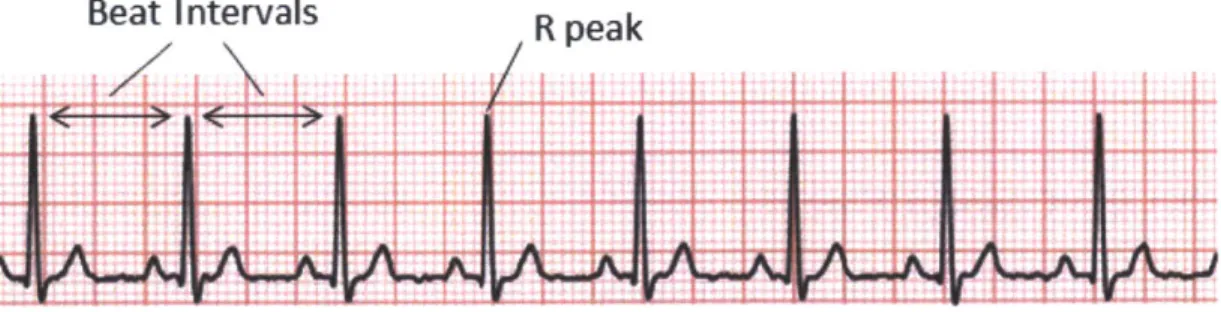 Figure  2-3:  Example  of typical ECG  signal.  Differences  between  R peaks  in successive beats  of  an  ECG  can  be  used  to calculate  heart  rate  variability  or  HRV.
