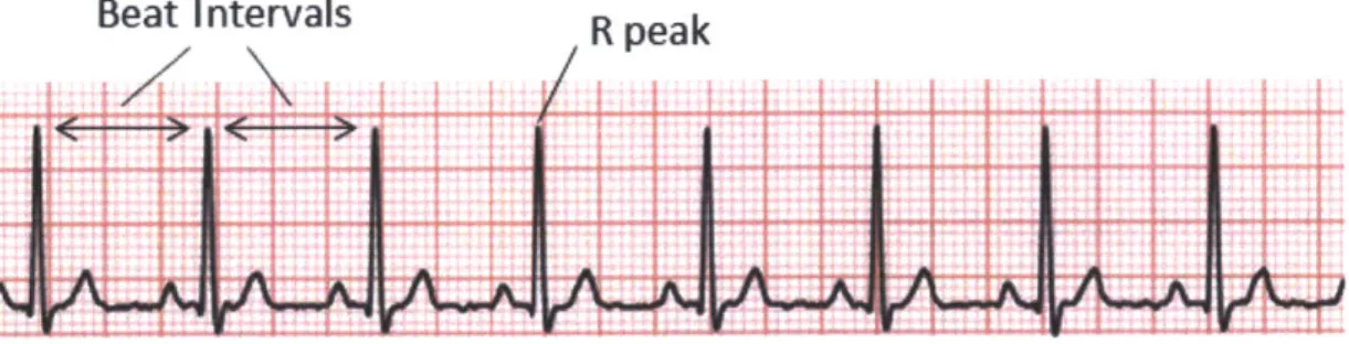 Figure  2-3:  Example  of typical ECG  signal.  Differences  between  R peaks  in successive beats  of  an  ECG  can  be  used  to calculate  heart  rate  variability  or  HRV.