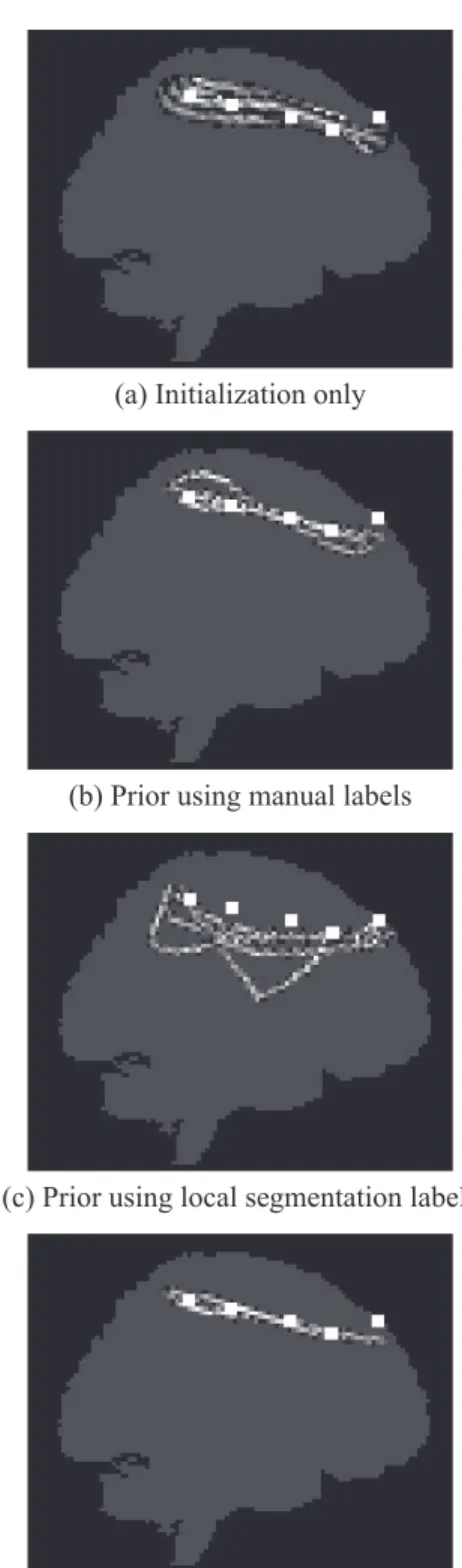 Fig. 2. SLF1 path posteriors from a single subject with differ- differ-ent end ROI sizes, reconstructed with differdiffer-ent types of  pri-ors