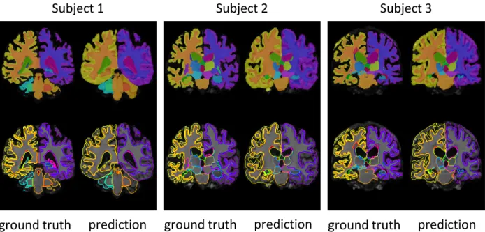 Figure 4. T1 segmentation examples. For each subject, the left column shows the ”ground truth” as estimated with FreeSurfer, and the right illustrates our prediction
