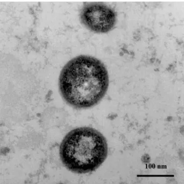 Figure 2. Electron photomicrographs of prostasomes purified from hu- hu-man semen. Three prostasomes appear as electron-dense material and show their size heterogeneity