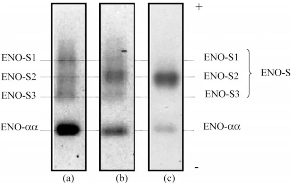 Figure 1. Enolase isoform patterns of Percoll-selected sperm fraction from (a) testicular sperm, (b) epididymal sperm, and (c) ejaculated spermatozoa.