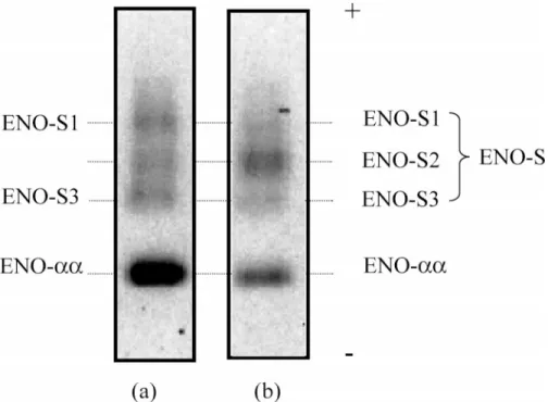 Figure 2. Enolase isoform patterns of Percoll-selected sperm fraction from (a) testicular sperm and (b) epididymal sperm from a man with obstructive azoospermia