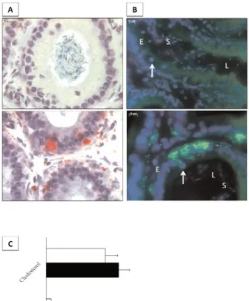 Fig. 1. Neutral lipid accumulations in caput epididymides of LXR- LXR-/- mice. (A) Oil red O staining on cryosections from wild-type (upper picture) or LXR-/- (bottom picture) caput epididymidis at 4 months of age