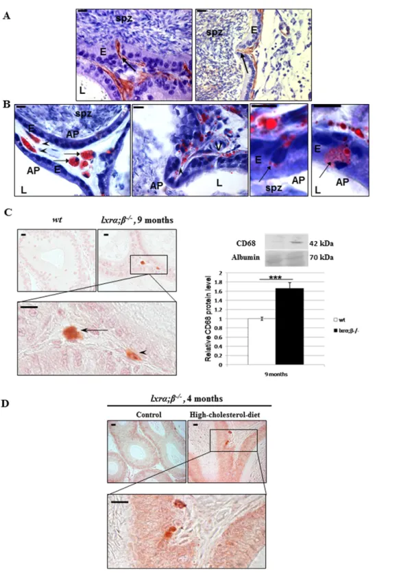 Figure 5. Transdifferentiation of epididymal peritubular SMC into foam cells in 9-month-old lxra;b2/2 animals as well as in high- high-cholesterol diet-fed 4-month-old lxra;b2/2 animals