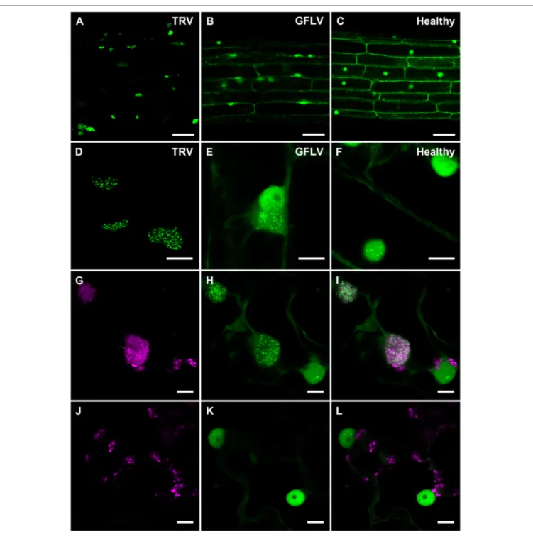 FIGURE 6 | Confocal imaging of B2:GFP in roots from TRV- and GFLV-infected dsRNA reporter N