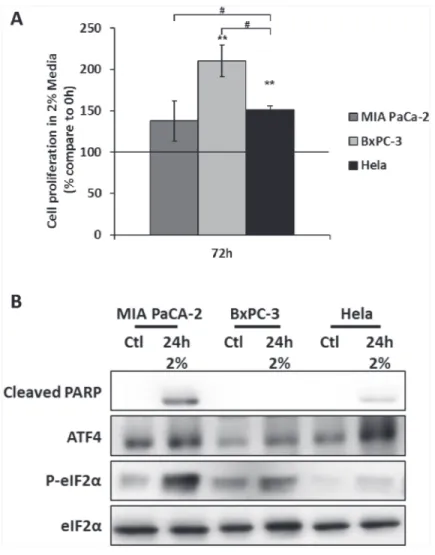 Figure 5: The expression of ATF4 is associated to the resistance to amino acid deprivation in the cancer cell line BxPC- BxPC-3