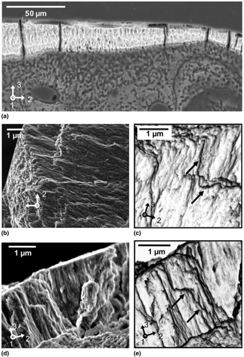 FIG. 3. (a) Backscattered electron microscopy images of the cross section of ganoine and dentin layers of the polished P
