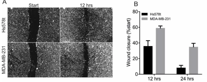 Figure S4: Wound healing assay of both basal B Hs578t and MDA-MB-231 cell lines show that  367 