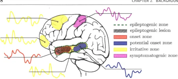 Figure  2.2:  In  resting  state  fMRI  an  interictal  BOLD  time  series  is  observed  at  each voxel