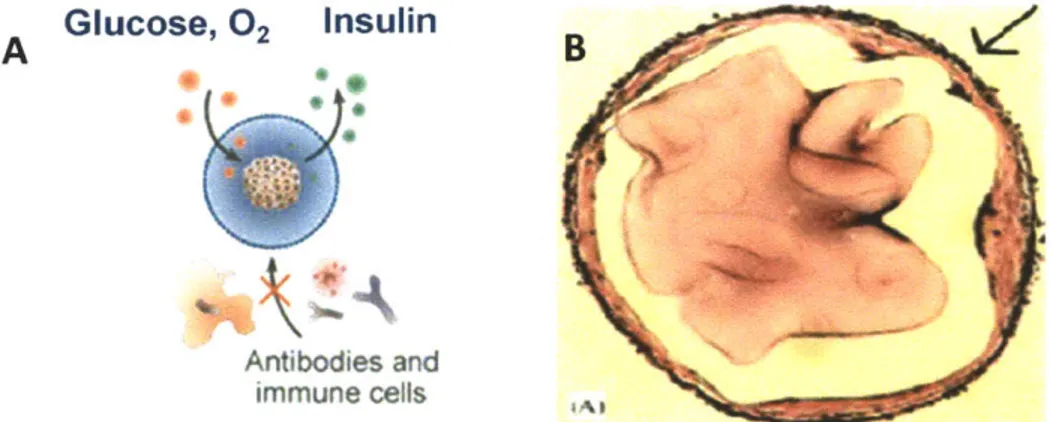 Figure 1.2:  Immuno-isolation  of islets and fibrosis response after transplantation.