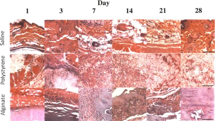 Figure 2.5:  H&amp;E  staining of representative sections subcutaneously injected materials.