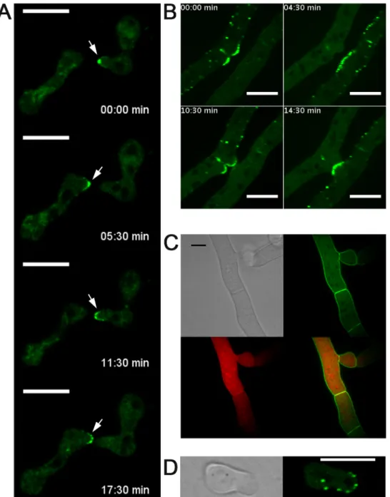Fig 4. Cellular localization of DOC-1-GFP and DOC-2-GFP. (A) DOC-1-GFP showed dynamic localization to puncta at the tips of conidial anastomosis tubes during chemotropic interactions between genetically identical cells, with an oscillation period of 8 – 10