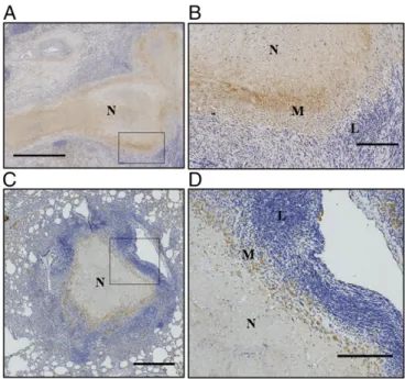 Fig. 1. Human and rabbit granulomas express VEGF. Representative line- line-scanned histological sections from human patients after lung tissue resection surgery (A and B) and from necropsied rabbits (C and D) show VEGF expression (brown) in the cellular l