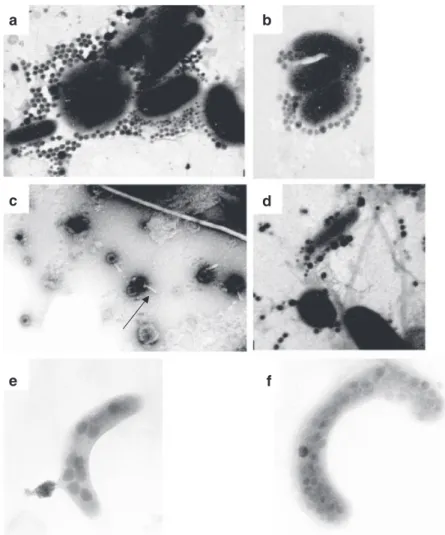 Fig. 5 Transmission electronic micropho- micropho-tographs of free viral particles and  bac-teria infected with viruses from Lake Bourget