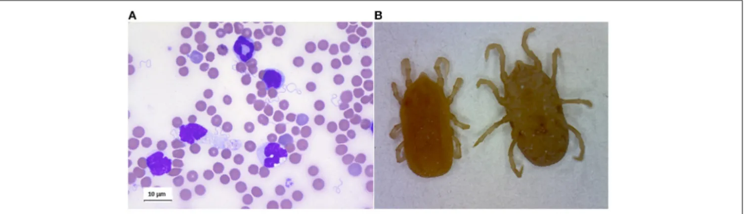 FIGURE 4 | (A) Giemsa staing of blood smear of mouse infected by Borrelia crocidurae. (B) Ornithodoros erraticus adult, dorsal, and ventral views.