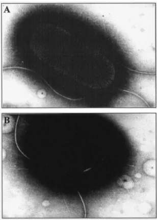 FIG. 4. Restoration of the invasion defect of the E. coli LF82- ⌬ yfgL isogenic mutant after transcomplementation with the plasmid pPBI07 harboring the entire LF82 yfgL gene