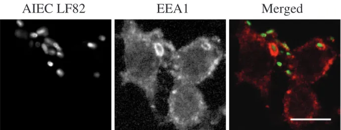 Fig. 1. The early endosome-associated antigen 1, EEA1, localizes on AIEC LF82-containing phagosomes immediately after infection