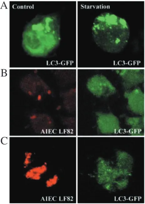 Fig. 5. AIEC LF82-containing phagosomes do  not colocalize with LC3, the specific marker of  the autophagic pathway