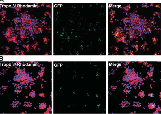 Fig. 3. AIEC LF82 colocalize with cellular aggregates. PBMC aggregates induced by GFP-expressing AIEC LF82 (moi: 10 2 ) were collected after 2 h (A) and 9 days (B) of incubation