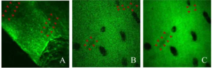 FIGURE 9. SHG micrographs of hyaline cartilage from a fixed slice of acetabular chondral flap excised from the impinging area of