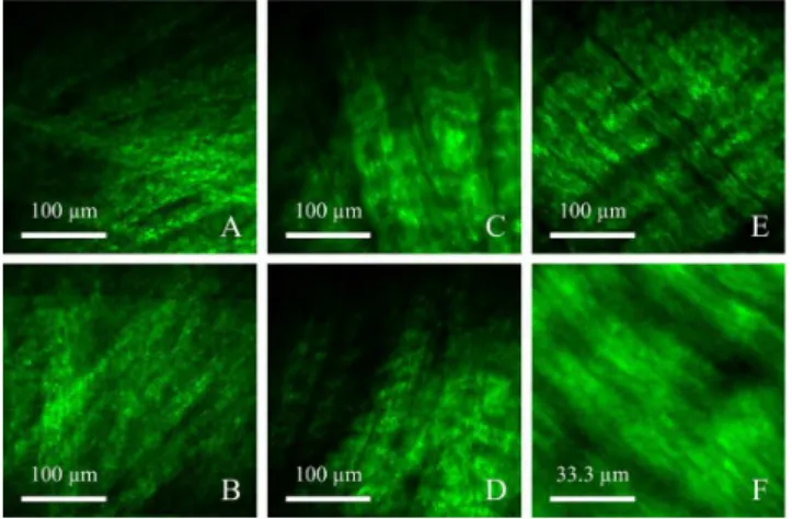 FIGURE 6. SHG micrographs of softer tissues comprised of primarily Type I Collagen. (A–D) depict SHG micrographs of meniscal microstructure from the femoral side of a thick curved portion of a submerged and immobilized meniscus