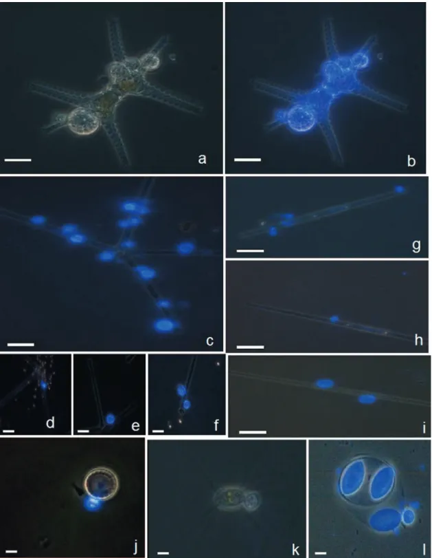 FIG. 2. Examples of microscopic micrographs of phytoplankton eukaryotes with CFW-stained chytrid parasites, obtained via the fractionated community approach