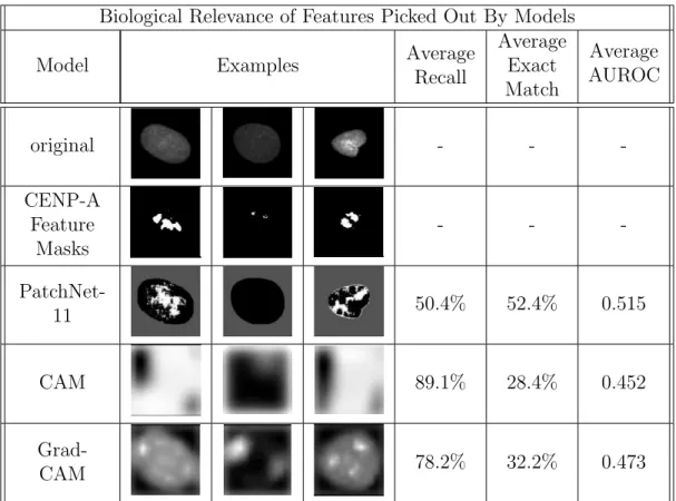 Table 3.3: Comparison of PatchNet-11, CAM and Grad-CAM visualizations with that of CENP-A markers which are associated with heterochromatin regions that are a feature of the early onset of cancer