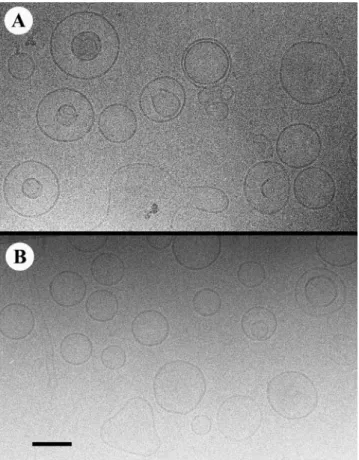 FIGURE 3 (A–C) Examples of cryoelectron micrographs showing LUVs prepared by MLVs extrusion under N 2 pressure through 200-nm pores.