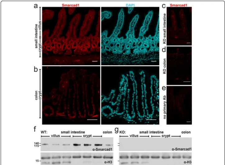 Fig. 1 Smarcad1 localization in the intestinal tract and Vil-cre-mediated KO. a – e Intestinal epithelium localization of Smarcad1 (red) by IF staining and nuclear counterstaining with DAPI (cyan) shown as maximum intensity projections