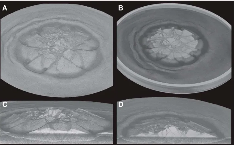 Figure 3. Low cohesion sand cone volume reconstructed from X-ray scan after 72 h of spreading over a 4.5 mm silicone layer
