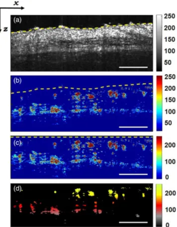 Figure 4 compares the difference in number and location of histological slices and OCT scans analyzed in each animal.