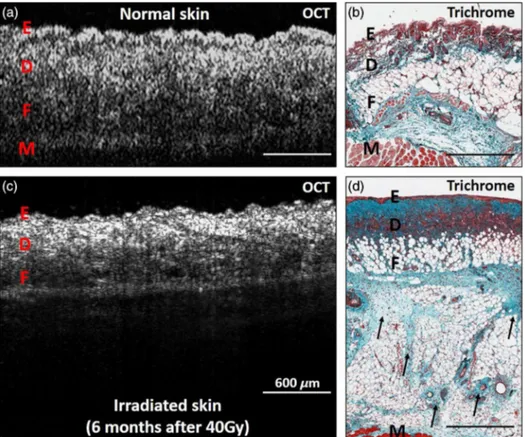 Figure 5 shows OCT and Masson ’ s trichrome histological images taken from nonirradiated and irradiated thighs of a C3H mouse, to demonstrate differences in tissue layer organization and distinguish collagen from fatty and muscular tissues