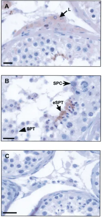 FIG. 6. Immunolocalization of the beta-defensin HBD-1 in human sperm smears. An anti-HBD-1 rabbit polyclonal antiserum was used at a dilution of 1:500 and immunoreaction was revealed with AEC or  diami-nobenzidine (insert)